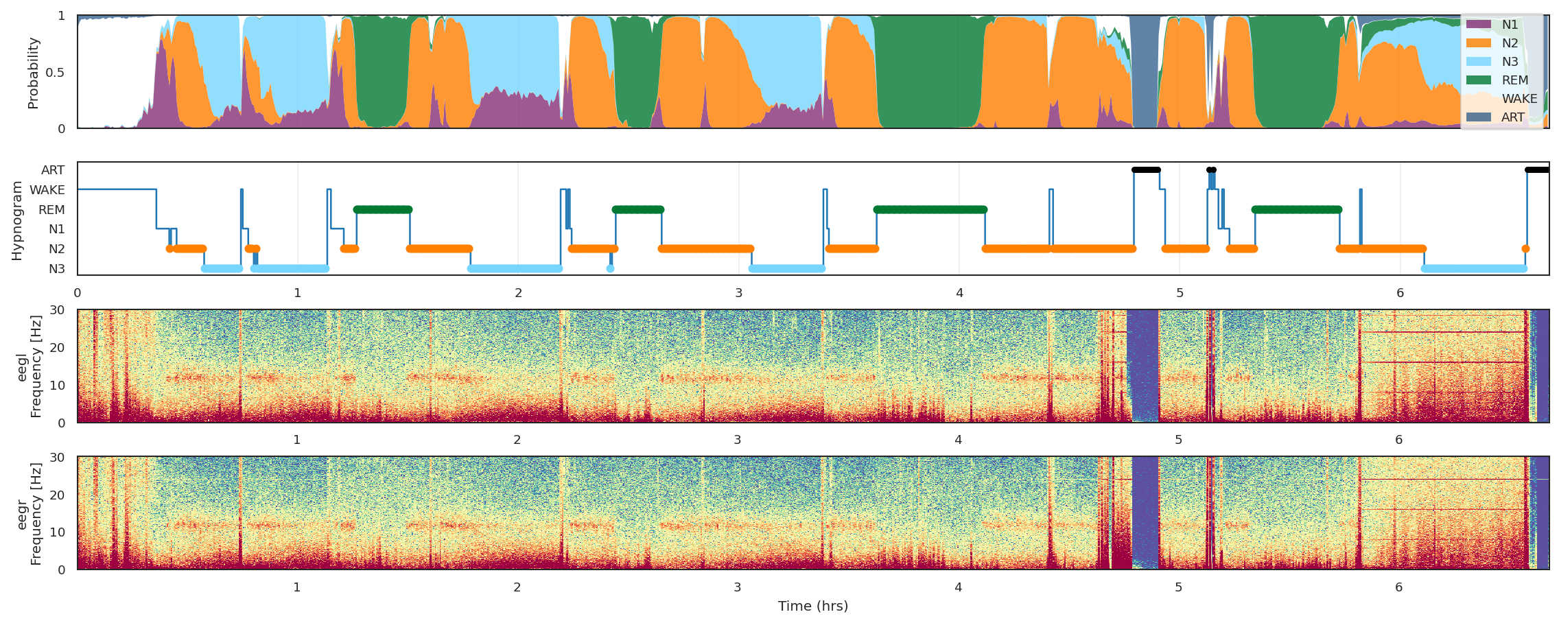 Screenshot of the NIDRA dashboard